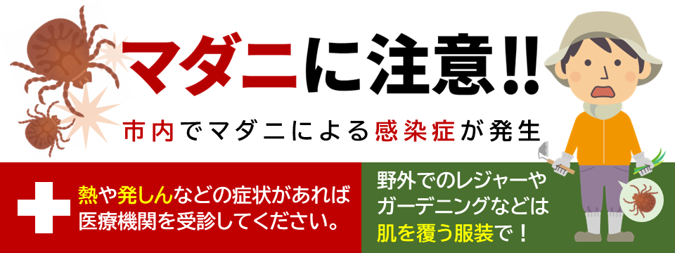 マダニに注意