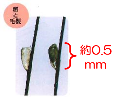 ＜アタマジラミの卵＞の画像