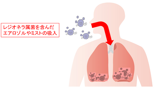 レジオネラ属菌を含んだエアロゾルやミストの吸入のイラスト