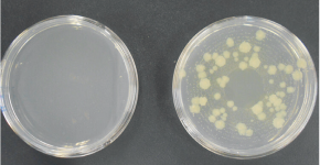 細菌の増殖を示した写真