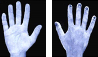 手洗い前の写真