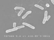 腸管出血性大腸菌O157の画像