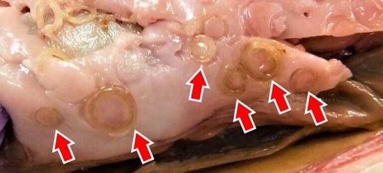 アニサキスの写真
