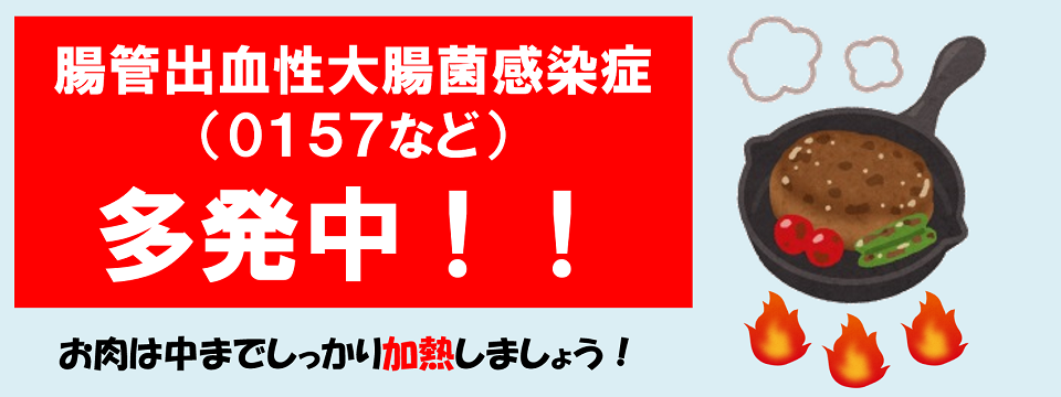 腸管出血性大腸菌感染症多発中！！