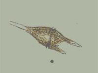 渦鞭毛藻類（Ceratium）の画像