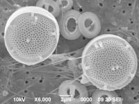 珪藻類（Thalassiosira）の画像