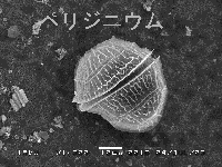 ペリジニウムの電子顕微鏡写真