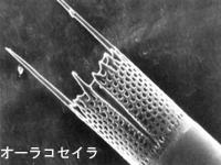 オーラコセイラの電子顕微鏡写真