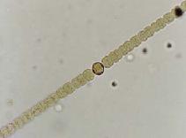 アナベナの画像