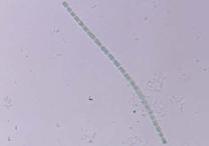 フォルミジウムの画像