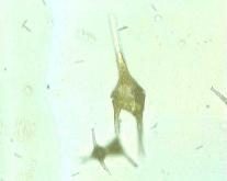 ケラチウムの画像